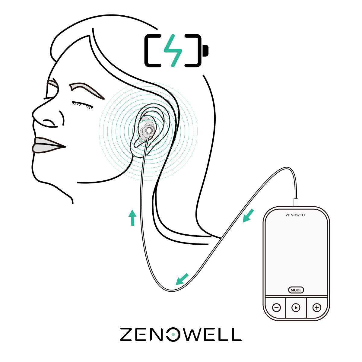 Can Non-Invasive Vagus Nerve Stimulation Rescue Burnt-Out Workers? New Study Reveals Cognitive Enhancement Potential