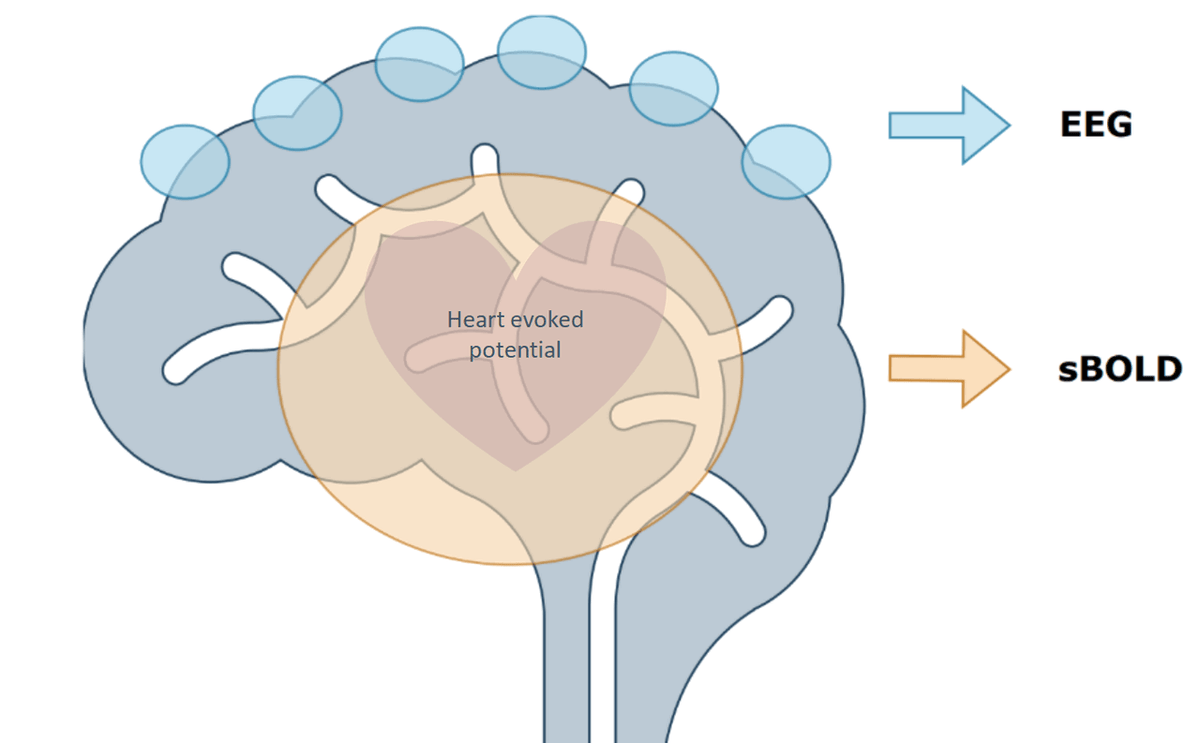 Schéma du cerveau montrant le potentiel évoqué par les battements cardiaques et les voies de l’EEG.